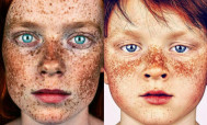 Լուսանկարիչ Բրոք Էլբանկն իր Freckles նախագծում հավաքել է պեպեններ ունեցող մարդկանց՝ նպատակ ունենալով ընդգծել նրանց բնական գեղեցկությունը